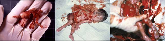 ��̥���С��