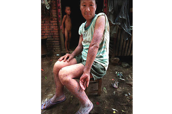 艾滋病病人及家人痛苦相片 <wbr> <wbr>好好念佛!远离邪淫,远离灾难 <wbr>南无阿弥陀佛 艾滋病病人及家人痛苦相片 好好念佛!远离邪淫,远离灾难 南无阿弥陀佛 - 感恩感谢 - 感恩传统文化博客amtb.cn.pn