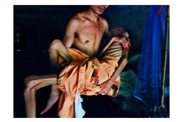 艾滋病病人及家人痛苦相片 <wbr> <wbr>好好念佛!远离邪淫,远离灾难 <wbr>南无阿弥陀佛 艾滋病病人及家人痛苦相片 好好念佛!远离邪淫,远离灾难 南无阿弥陀佛 - 感恩感谢 - 感恩传统文化博客amtb.cn.pn